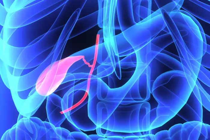 robotic laparoscopic cholecystectomy - How long does it take to recover from robotic gallbladder removal