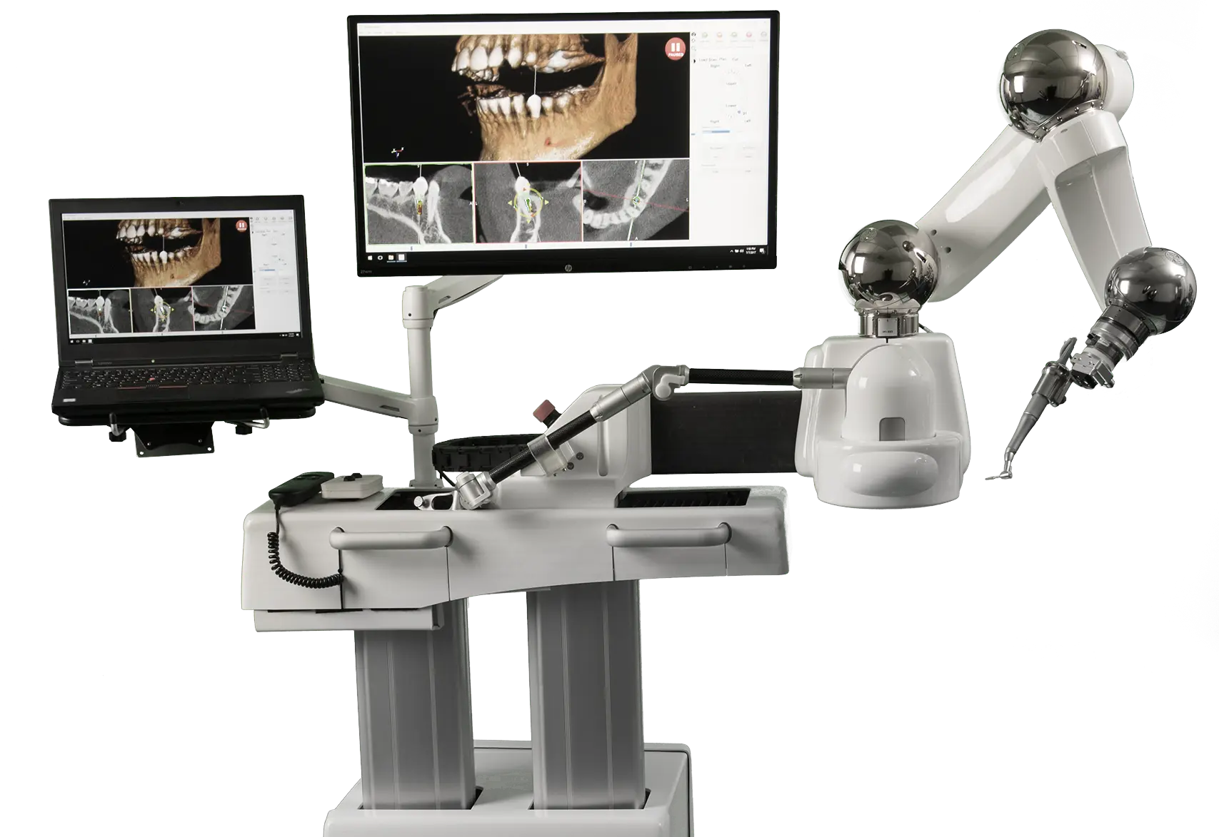 robot dentist - How much does Neocis Yomi cost