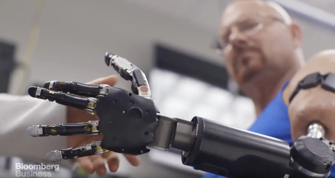 Prótesis robóticas: El futuro de la rehabilitación - Qué son las prótesis robóticas protesis roboticas - Qué son las prótesis robóticas